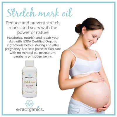 eraorganics natural stretch mark cream oil