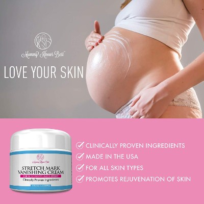 mommy knows best vanishing stretch mark cream belly