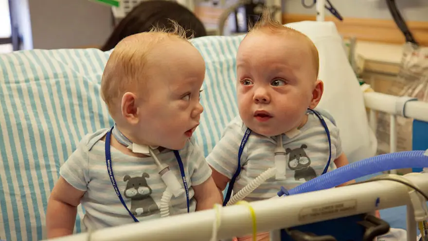 The Dangers of Twin Births The Dangers of Twin Births