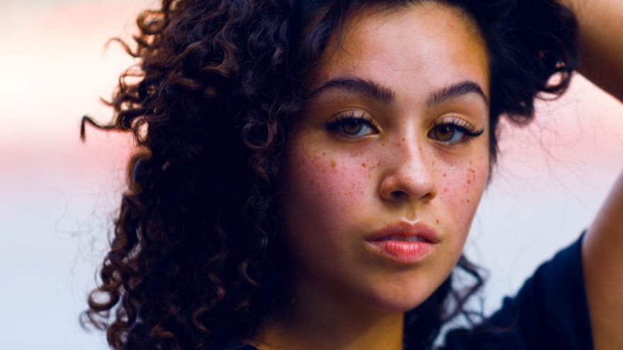 7 Foods to Avoid for an Acne-Free Face A healthy diet can solve problems with acne in teens.
